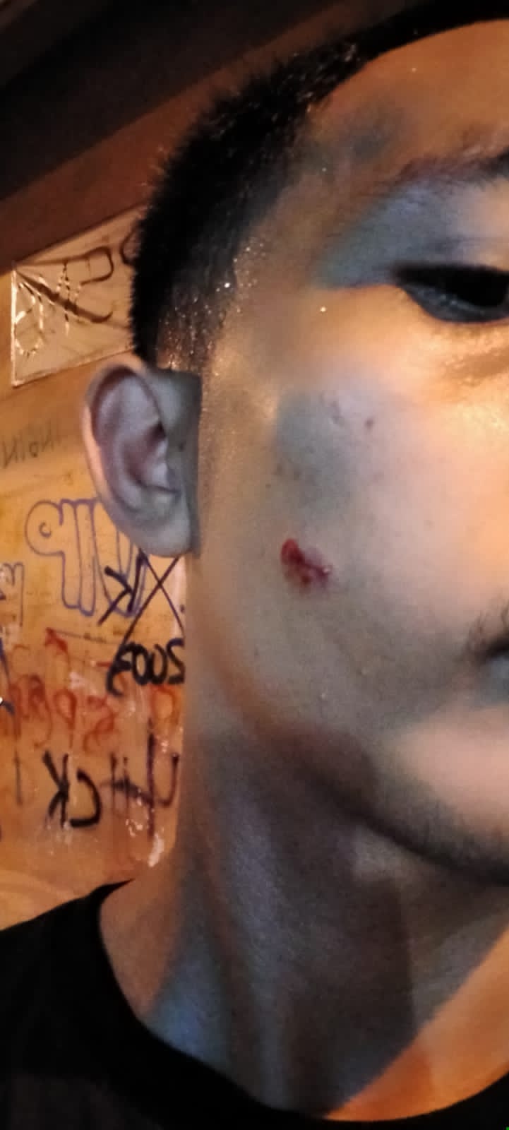 Berniat Melerai, Iqbal Anak Wartawan Unit Polda Sumut Malah Babak Belur