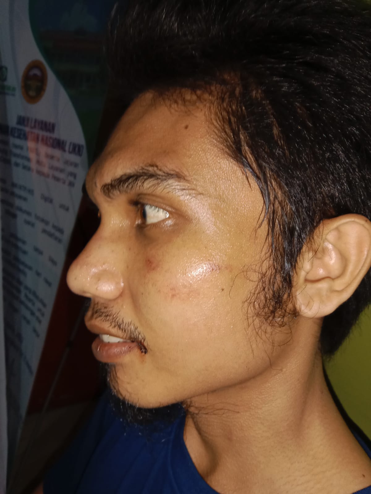 Kasus Penganiayaan & Pengeroyokan, Polsek Deli Tua Keluarkan Surat Penjemputan Paksa