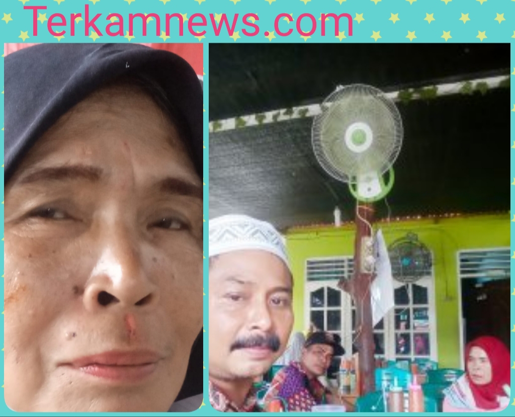 Caleg Wanita Aniaya Wartawati, Korban Melapor Ke Polres Tebing Tinggi