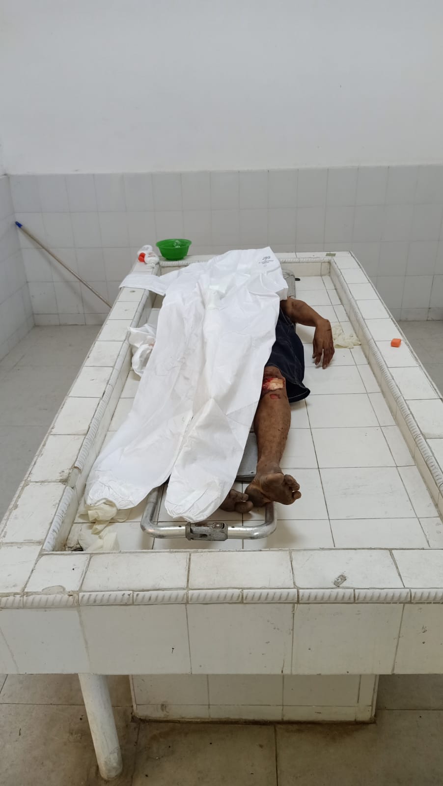 Ular Besi Kembali Memakan Korban, Pria Tanpa Identitas Tewas Dengan Luka Parah.