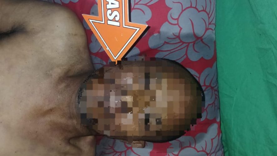Polsek Perbaungan Polres Sergai Lakukan Cek TKP Telah Ditemukan Mayat Seorang Pria Di Pajak Baru, Kec Perbaungan 