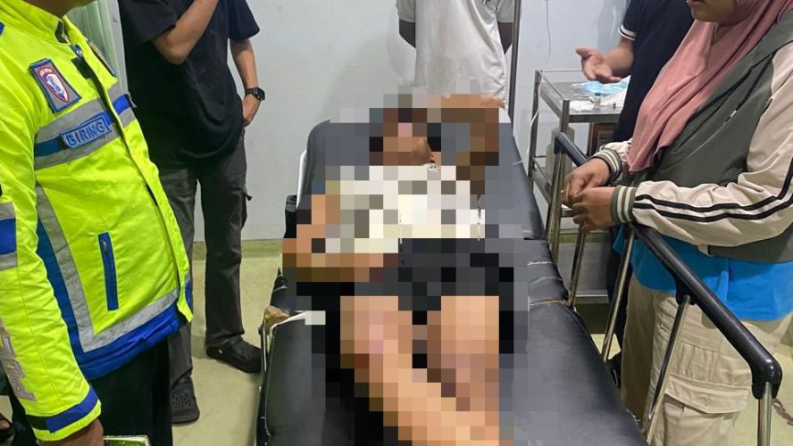 Lalai Dan Tak Pakai Helm, Dua Sepeda Motor Tabrakan Di Sergai, 4 Orang Luka-Luka